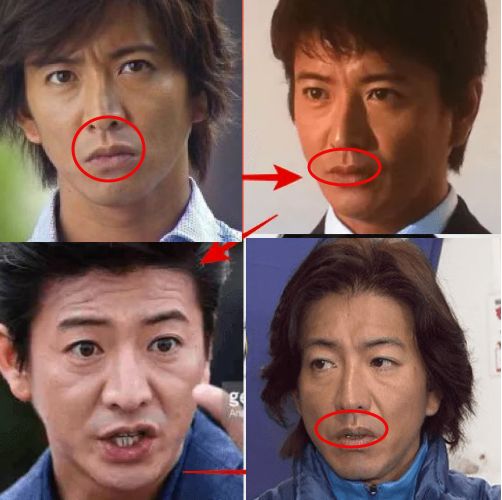 如何挽救老男人的脸 122 如何挽救老男人的脸