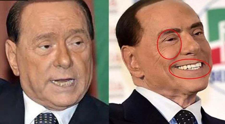 如何挽救老男人的脸 108 如何挽救老男人的脸